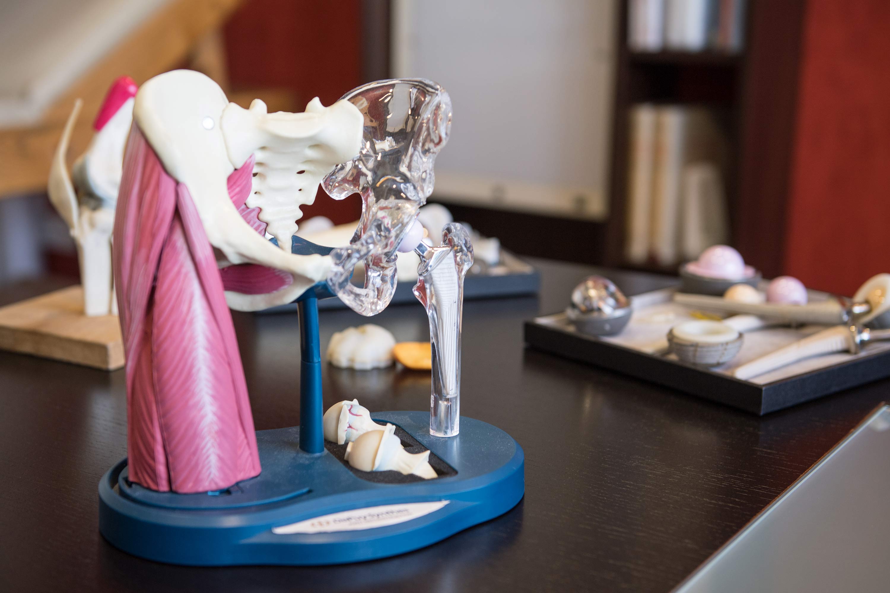 Mod&egrave;le anatomique de hanche avec muscles et articulation sur table m&eacute;dicale